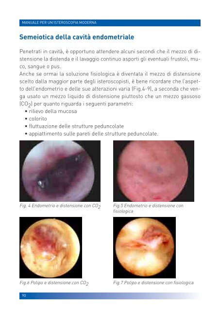 manuale per un'isteroscopia moderna - Ginecologia