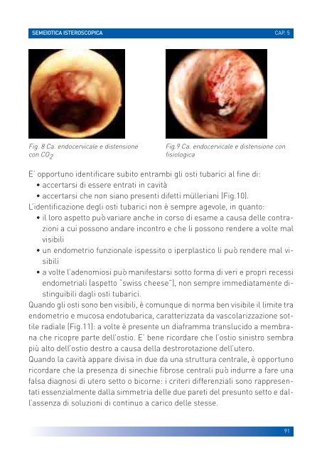 manuale per un'isteroscopia moderna - Ginecologia