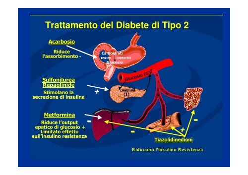 Ipoglicemia nel Diabete: Prevenzione e trattamento