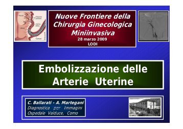 Embolizzazione delle A t i Ut i Arterie Uterine - Cigonline.It