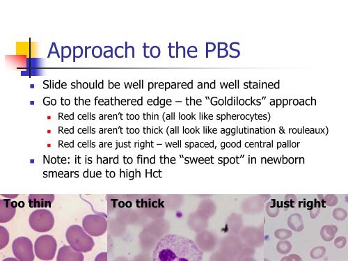 Utility of the peripheral smear and laboratory studies in the ...