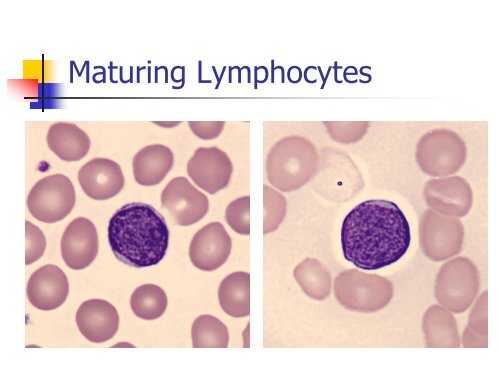 Utility of the peripheral smear and laboratory studies in the ...