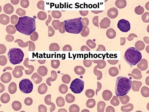 Utility of the peripheral smear and laboratory studies in the ...