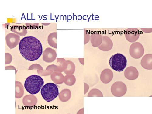 Utility of the peripheral smear and laboratory studies in the ...