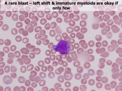 Utility of the peripheral smear and laboratory studies in the ...