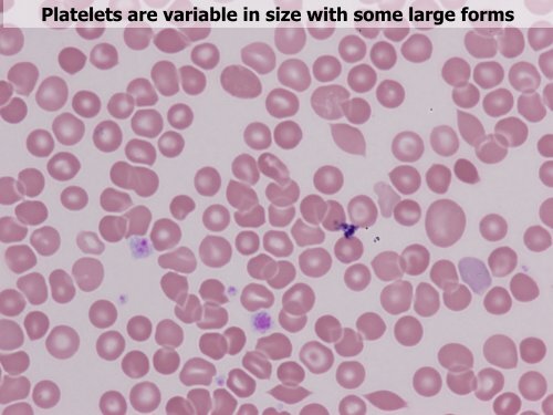 Utility of the peripheral smear and laboratory studies in the ...