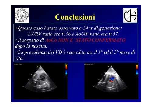 Prevalenza destra in epoca fetale: studio retrospettivo di 100 ... - SICP