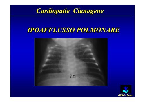 Cardiopatie Congenite Cianogene - Uticlab.It