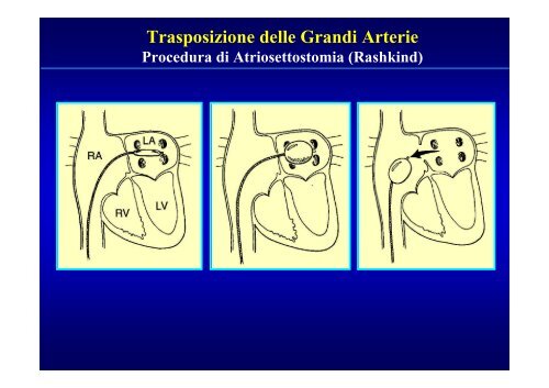 Cardiopatie Congenite Cianogene - Uticlab.It