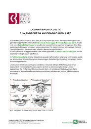 Spina bifida e sindrome da ancoraggio midollare - fondazione irccs ...
