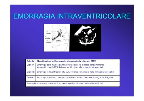 LE PARALISI CEREBRALI INFANTILI