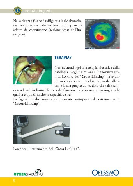 Il Cheratocono: conoscere per riconoscere - Lions Club Bagheria