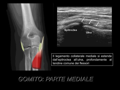 gomito: parte anteriore