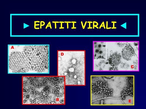 EPATITI VIRALI  - Facoltà di Medicina e Chirurgia