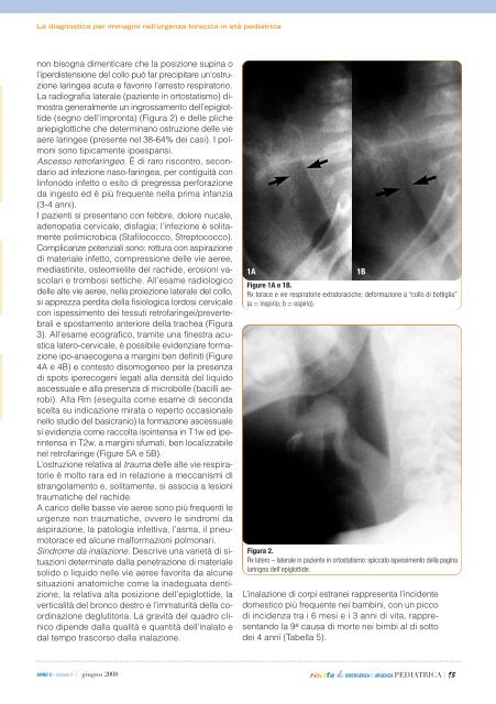 scarica la rivista in PDF - SIMEUP