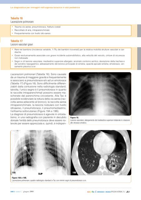 scarica la rivista in PDF - SIMEUP