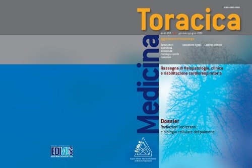 radiazione sincrona del carcinoma della prostata reivew