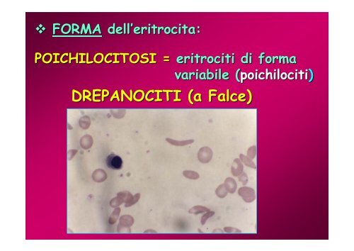 Fisiopatologia del SANGUE - Eritrociti