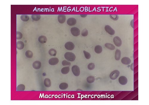 Fisiopatologia del SANGUE 1