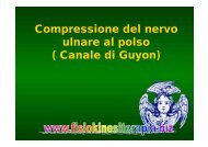 Compressione del nervo ulnare al polso ( Canale di Guyon)