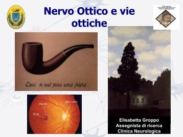 Nervo ottico e vie ottiche - Studio Oculistico dott. Amedeo Lucente