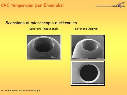 CVC TEMPORANEI: MATERIALI E TIPOLOGIA - Nefropiemonte.org