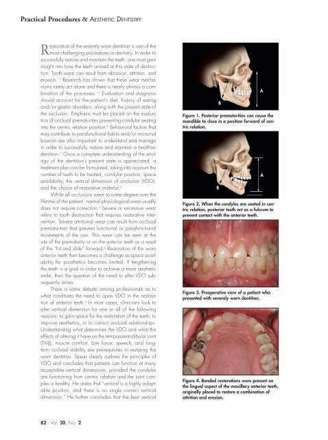 a systematic approach to full-mouth reconstruction of the severely ...