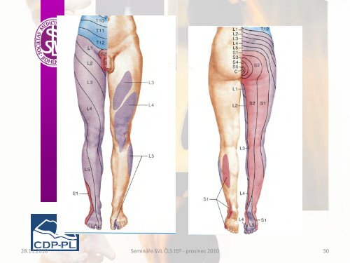 Bolesti zad vertebrogenní algický syndrom