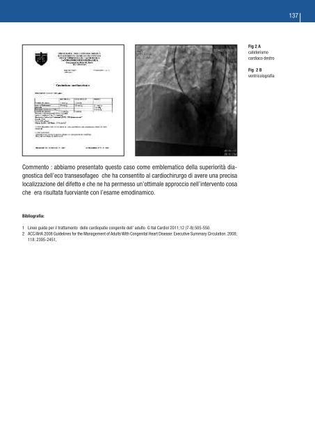 HEARTLINE HSM Genoa Cardiology Meeting - Aristea