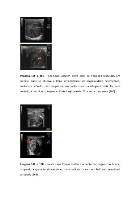 1 - LIVRO - Ultrassonografia doppler em Andrologia.pdf