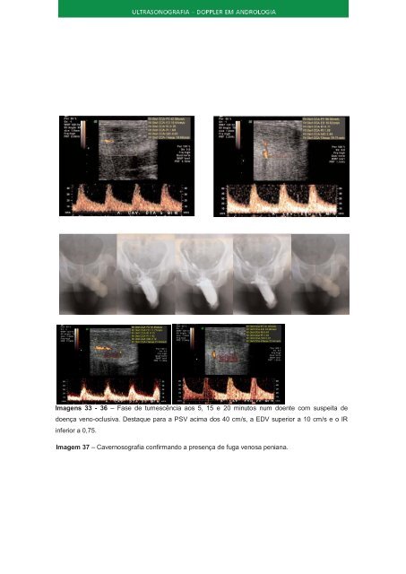 1 - LIVRO - Ultrassonografia doppler em Andrologia.pdf
