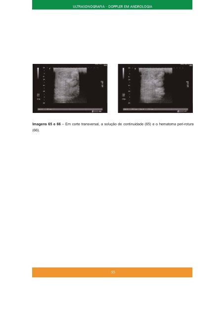 1 - LIVRO - Ultrassonografia doppler em Andrologia.pdf