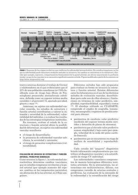 Estudio integral no invasivo de la estructura y función arterial