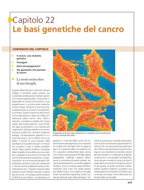 le radiazioni per il cancro alla prostata possono causare sarcomi