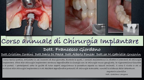 Corso annuale di Chirurgia Implantare - Dental Trey