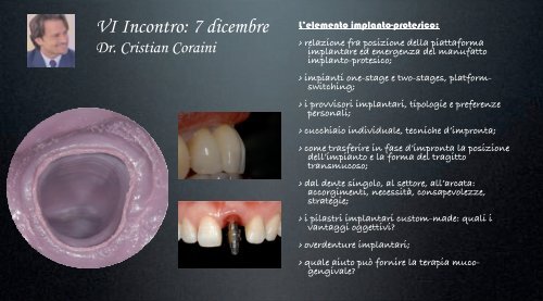 Corso annuale di Chirurgia Implantare - Dental Trey