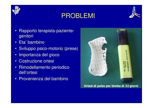 Principi di Riabilitazione della Mano Pediatrica