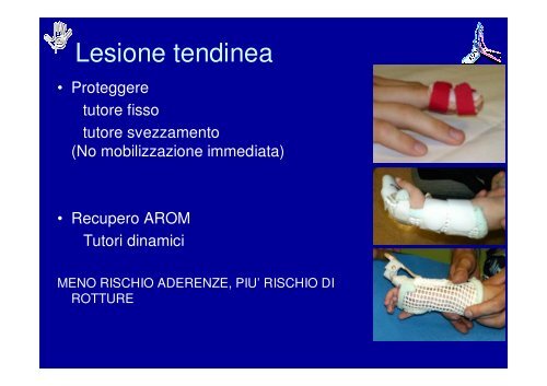 Principi di Riabilitazione della Mano Pediatrica