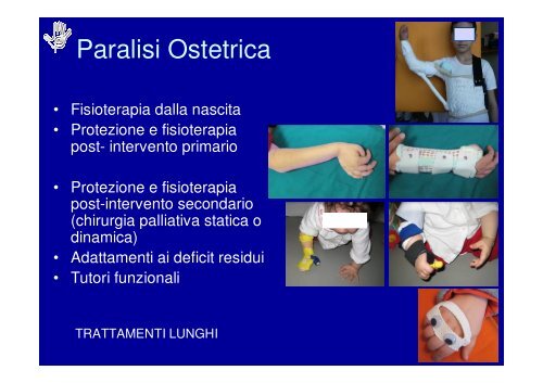 Principi di Riabilitazione della Mano Pediatrica