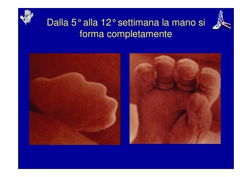 Principi di Riabilitazione della Mano Pediatrica