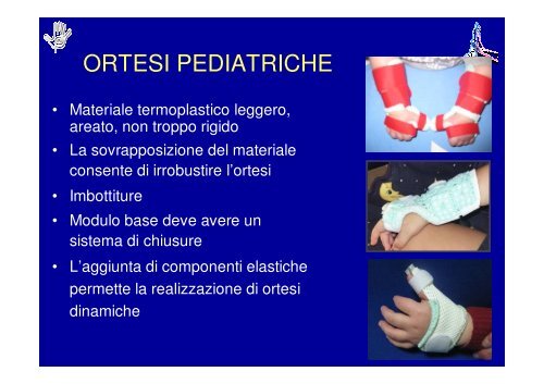 Principi di Riabilitazione della Mano Pediatrica