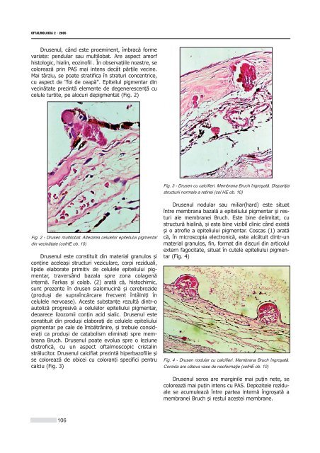 Interior 2_2005.qxd - Oftalmologia.ro