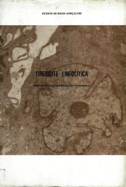 Tireoidite linfocítica - Repositório Aberto da Universidade do Porto