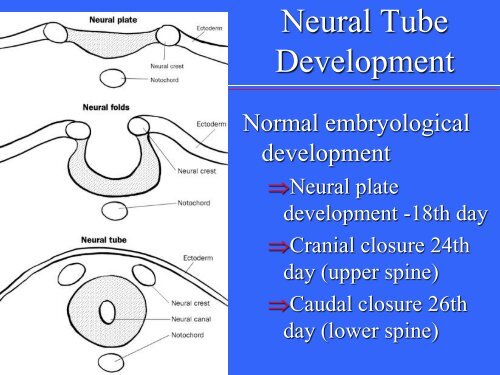 Neural Tube Defects