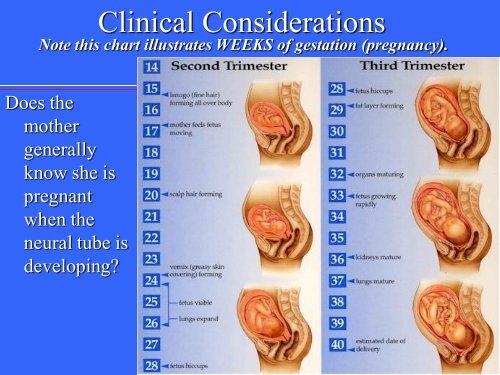 Neural Tube Defects