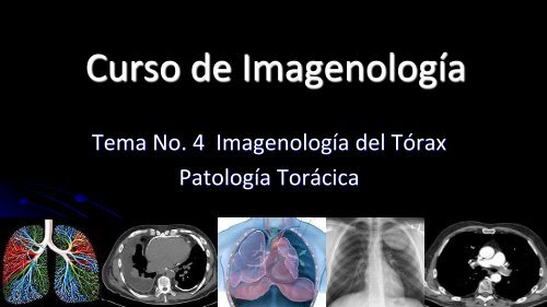 Curso de Radiología e Imagen, UANL