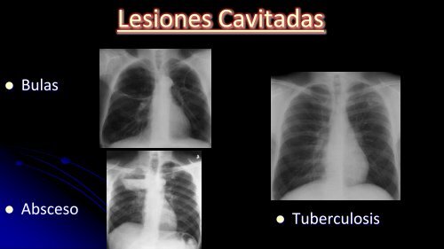 Curso de Radiología e Imagen, UANL