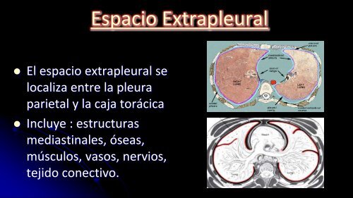 Curso de Radiología e Imagen, UANL