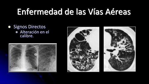 Curso de Radiología e Imagen, UANL