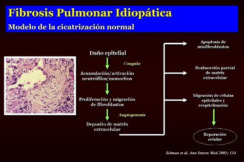 Ver plática - Sociedad Mexicana de Neumología y Cirugía de Tórax